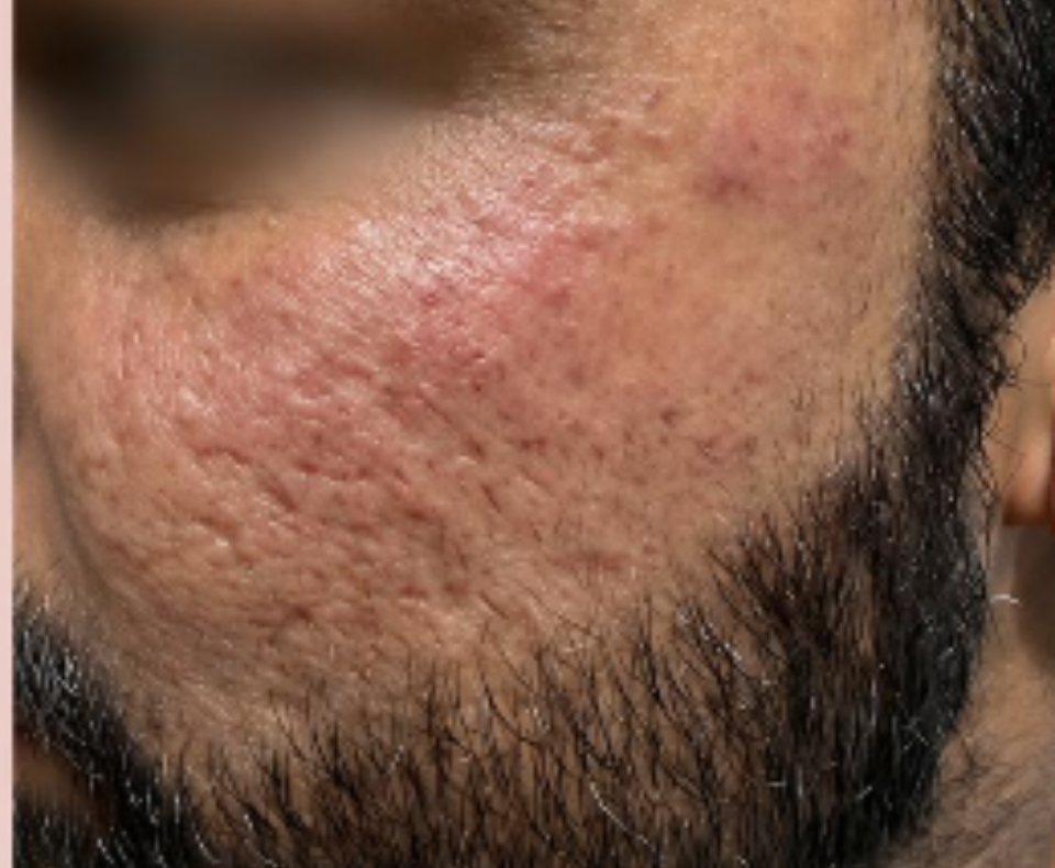 men befofre
